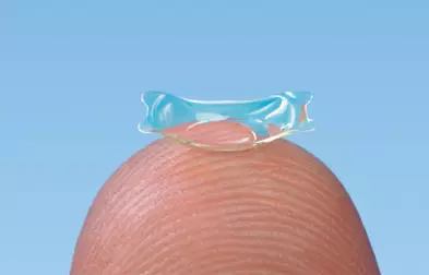 Kontaktlinse im Auge: Phake Linsen