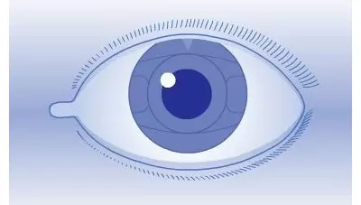 Die Vorderkammer Kunstlinse ist in der Regel mit dem bloßen Auge nicht sichtbar.